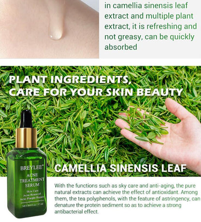 Acne Treatment & Facial Repair Serum