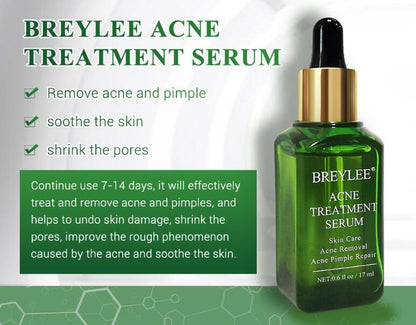 Acne Treatment & Facial Repair Serum